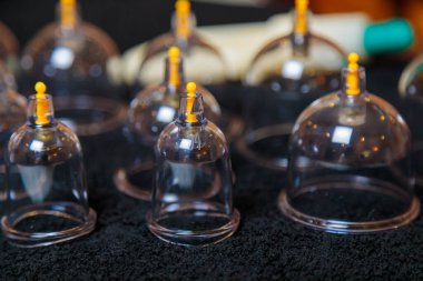 Hijama kanının iyileştirici işlemleri için vakum damarları.