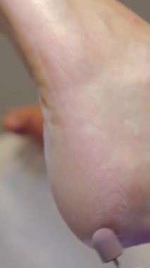 Bacaklarında pedikür olan bir kadın. Kadın derisini ve tırnaklarını önemsiyor. Kadın Ayağı. Kadın ayağı ve nasır sökücü alet. Ayak ve tırnakların tedavisi.