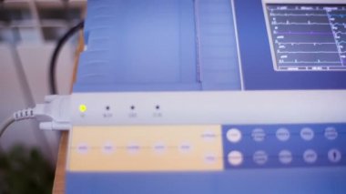 Elektrokardiyografi 01 Hd