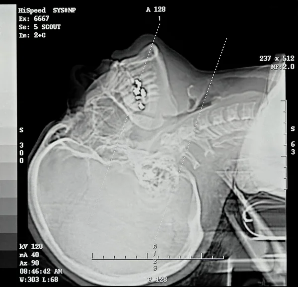 Escaneamento de CT Escoteiro — Fotografia de Stock