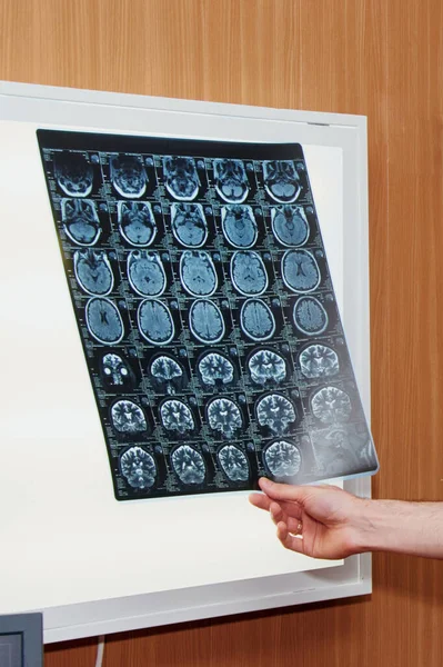 Doctor's hand holding x-ray of patient's brain with modern medical laboratory