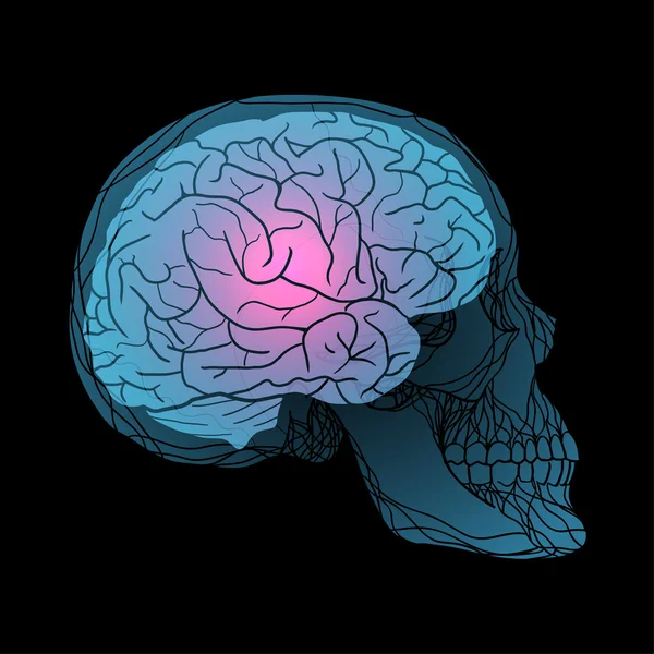 Röntgen av mänskliga skallen med hjärnan. — Stock vektor