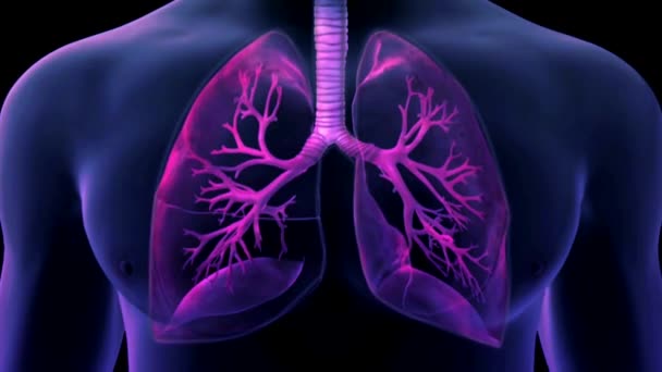 Los Pulmones Contagiados Animación Realista Imágenes Del Síndrome Respiratorio Agudo — Vídeos de Stock