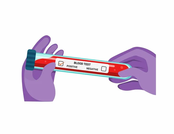 Hand Glove Holding Blood Tube Test Blood Sample Check Virus — Stock Vector