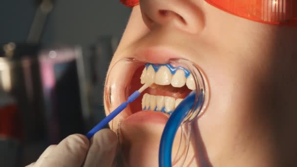 Whitening teeth closeup in slow motion — Stock Video