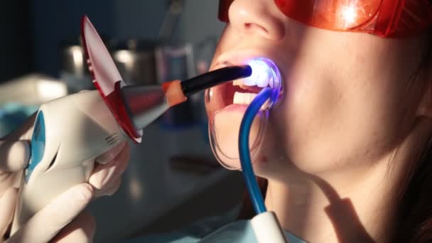 Zahnarzt arbeitet mit Zahnpolymerisationslampe in der Mundhöhle. — Stockvideo