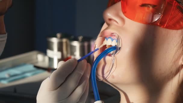 Отбеливание зубов крупным планом в замедленной съемке — стоковое видео