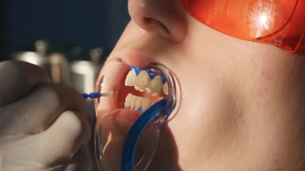 Blanqueamiento de dientes primer plano en cámara lenta — Vídeo de stock