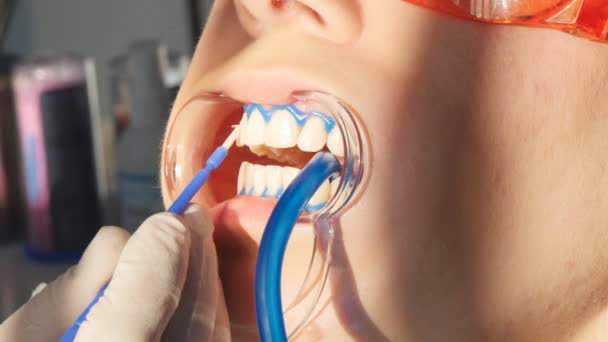 Blanchiment des dents en gros plan au ralenti — Video