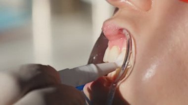 Beyazlatma dişler closeup yavaş hareket