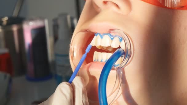 Blanqueamiento de dientes primer plano en cámara lenta — Vídeo de stock