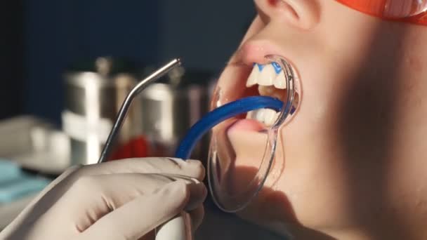 Отбеливание зубов крупным планом в замедленной съемке — стоковое видео