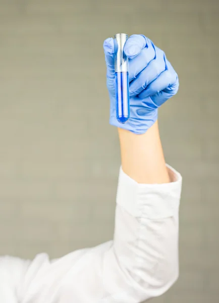 Närbild av glasrör med blå vätska i sjuksköterskans hand under medicinskt test — Stockfoto