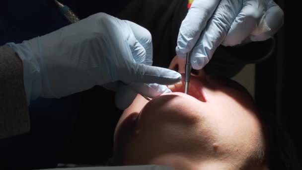 Cena de uma visita a um consultório de dentista — Vídeo de Stock