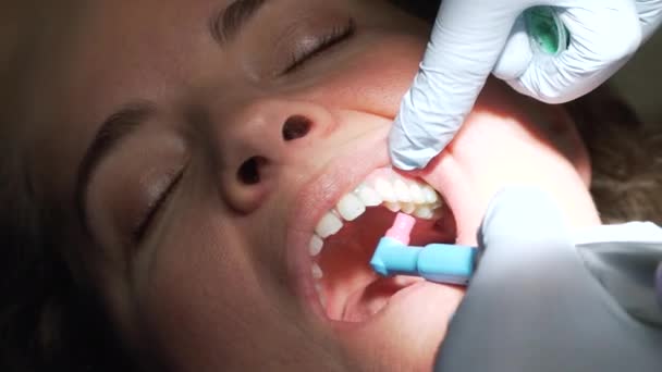 Scena di una visita a uno studio dentistico — Video Stock