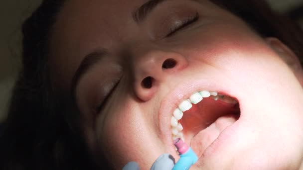 Scena z wizytą gabinet dentystyczny — Wideo stockowe