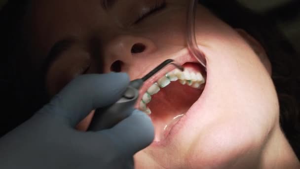 Scène uit een bezoek aan het kantoor van een tandarts — Stockvideo