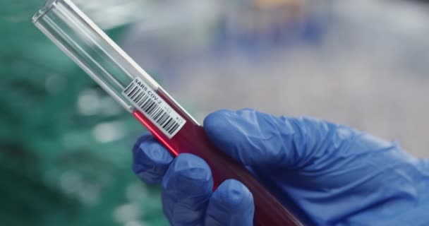 Beskär syn på mikrobiolog eller läkare hand i kirurgiska handskar med negativt markerade blodprov resultat Begreppet coronavirus, pandemi. — Stockvideo