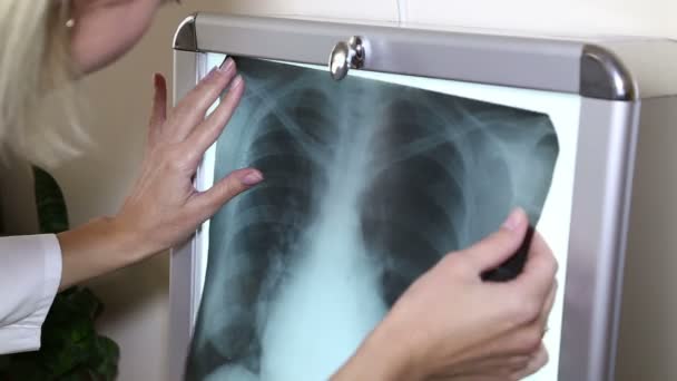 Médicos consideran los pulmones de rayos X — Vídeos de Stock