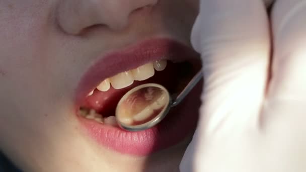 Осмотр полости рта и зубов — стоковое видео