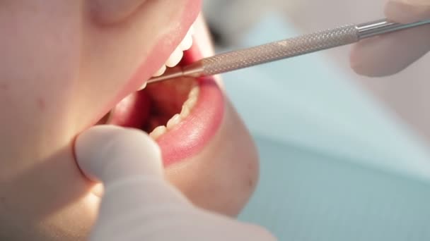 Examen de la bouche et des dents — Video