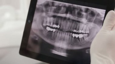 Diş hekimi bir hastanın röntgeni Tablet üzerinde gösterir.