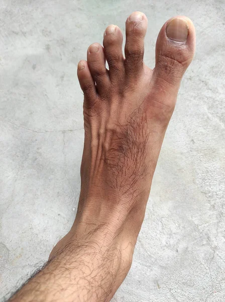 Man Foot Hair Fotók Háttér Maszat Szelektív Fókusz — Stock Fotó