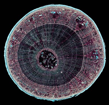 Siyah arkaplandaki bakterilerin mikroskop görüntüsü