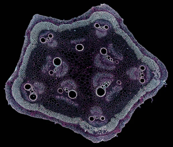 黒い背景の細菌の顕微鏡写真です — ストック写真