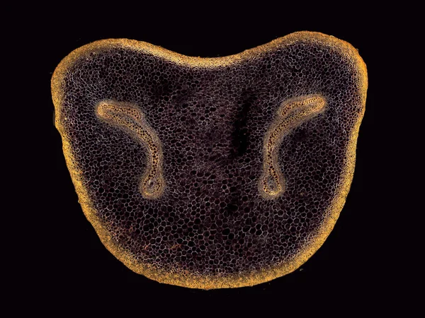 Mikroskop Záběr Abstraktního Prvku Buňky Tmavém Pozadí — Stock fotografie
