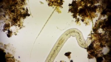 Hareket eden bakterilerin görünümü, mikroskop görüntüleri