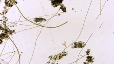 Hareket eden bakteri görüntüsü, mikroskop görüntüleri