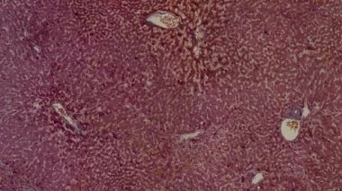 Karaciğer - mikroskop altında insan vücut hücreleri