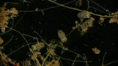 Hareket eden bakteri görüntüsü, mikroskop görüntüleri