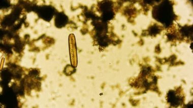 Hareket eden bakteri görüntüsü, mikroskop görüntüleri