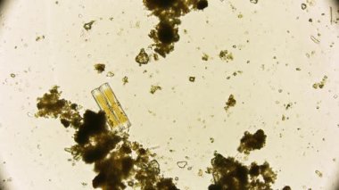 Hareket eden bakteri görüntüsü, mikroskop görüntüleri