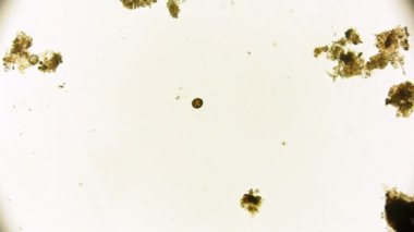 Hareket eden bakteri görüntüsü, mikroskop görüntüleri