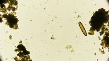 Hareket eden bakteri görüntüsü, mikroskop görüntüleri