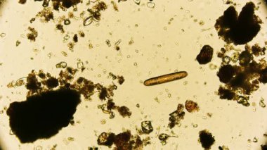 Hareket eden bakteri görüntüsü, mikroskop görüntüleri