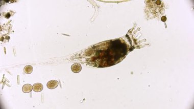 Hareket eden bakteri görüntüsü, mikroskop görüntüleri