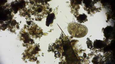 mikroskop altında mikroorganizma - mikro evren 