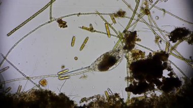 Hareket eden bakteri görüntüsü, mikroskop görüntüleri