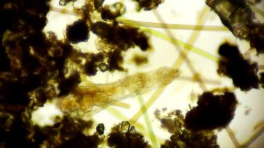 Hareket eden bakteri görüntüsü, mikroskop görüntüleri