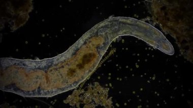 Hareket eden bakteri görüntüsü, mikroskop görüntüleri