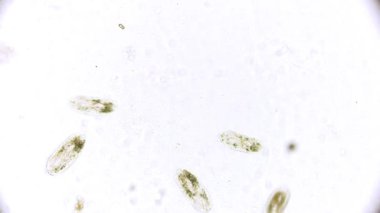 tek hücreli mikroorganizma - mikroskop altında Terliksi hayvan