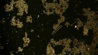 Hareket eden bakteri görüntüsü, mikroskop görüntüleri