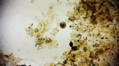 Mikroskop altında tek hücreli mikroorganizma