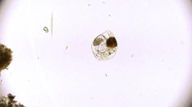 Hareket eden bakteri görüntüsü, mikroskop görüntüleri