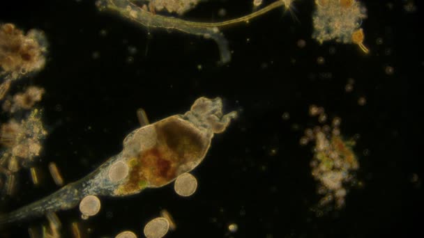 Вид Рухомих Бактерій Мікроскопні Кадри — стокове відео
