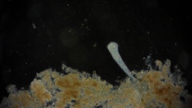 Hareket eden bakteri görüntüsü, mikroskop görüntüleri